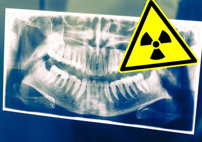 Dentistionline – Nuovo corso Radioprotezione del paziente ai sensi dell’art.162 del D.LGS. 101/2020