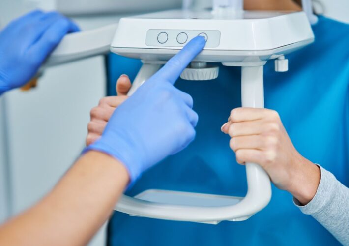 CBCT: indicazioni, vantaggi, criticità – Partecipa al sondaggio