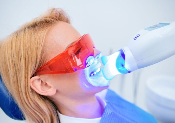 Incredibile ma vero! Due Ministeri per ribadire chi può eseguire gli sbiancamenti dentali